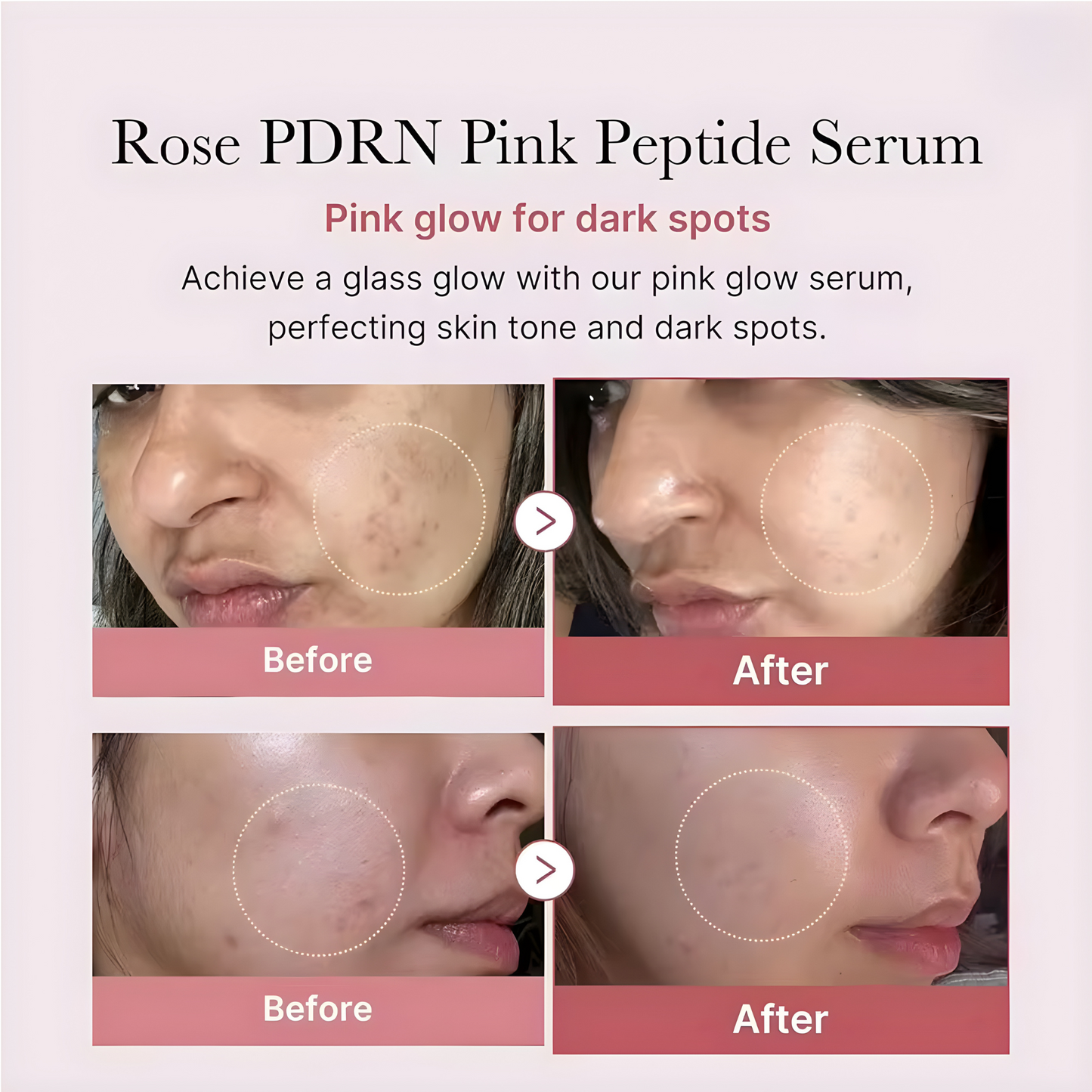 PDRN Pink Peptide Serum