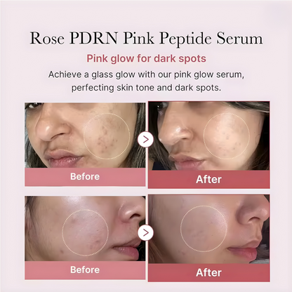 PDRN Pink Peptide Serum